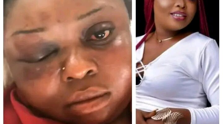 Man Panel Beats Girlfriend For Refusing To Marry Him In Delta- Activist Call For Prosecution