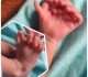 Amazing Story Of Baby Born With 7 Fingers On Each Hand, 6 Toes On Each Foot