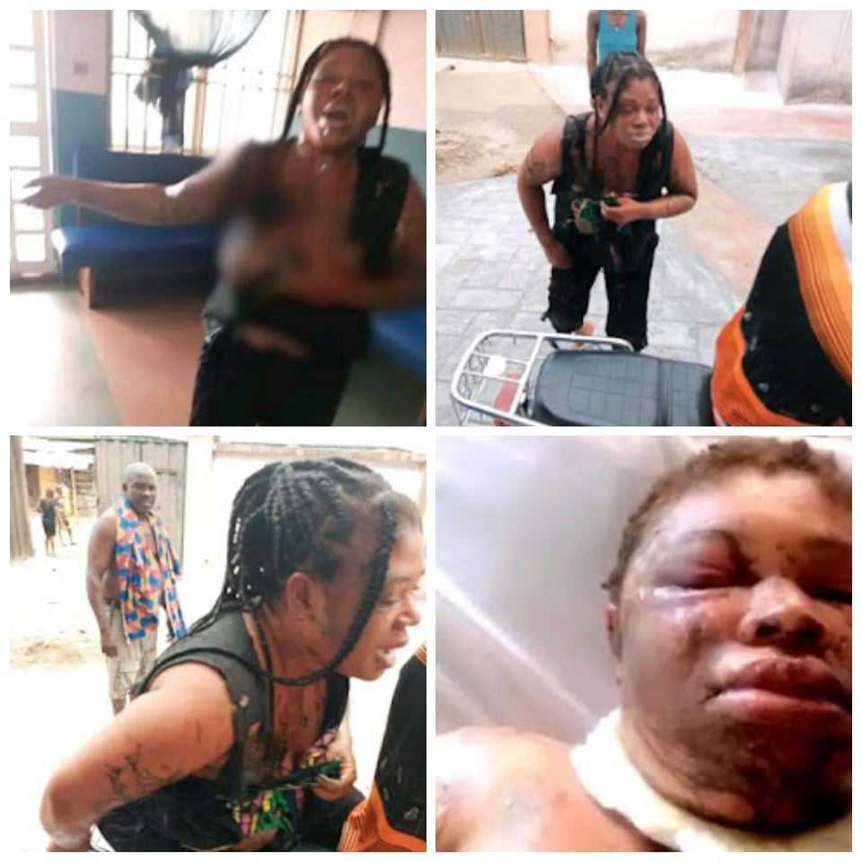 Jealous Husband Attacks Wife With Digger, Pours Acid On Her Face In Oyibo