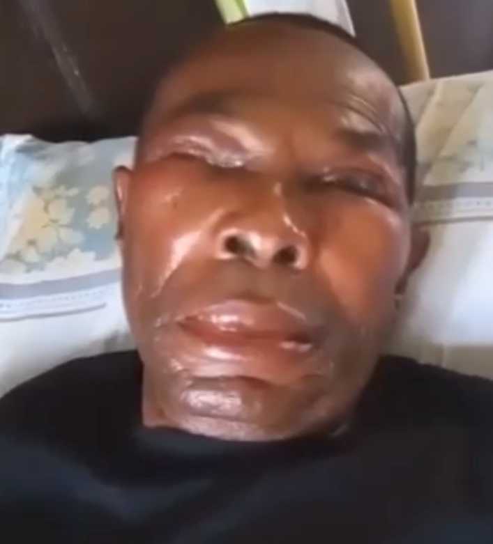 Inhumanity- Yet To-Be-Identified Man Baths Joe Igbokwe Kinsman With Acid In Nnewi