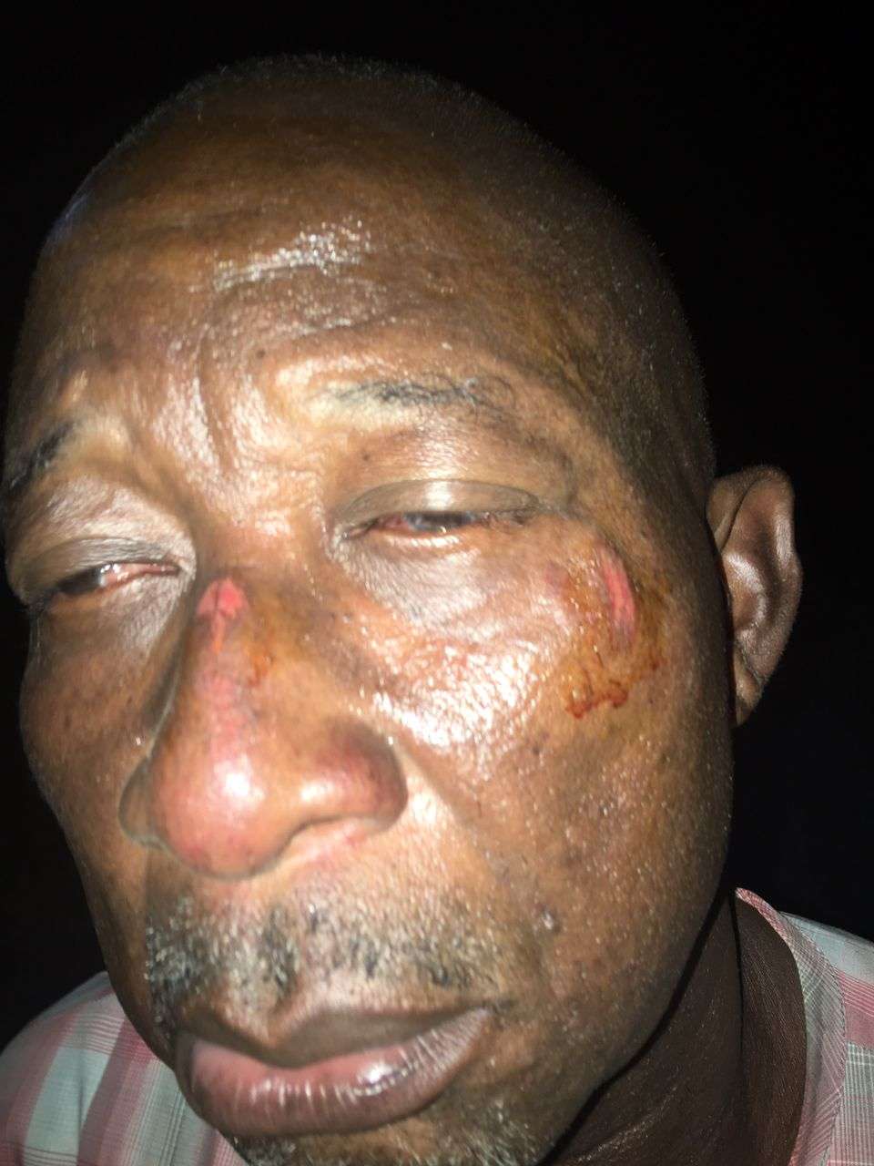 Man Accuse Degema LGA Council Boss Of Physically Assaulting Him, Call For Justice