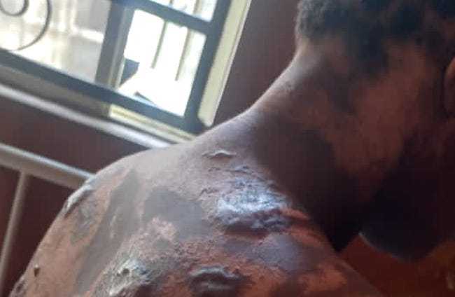 Landlady Arrested For Allegedly Bathing Tenant Hot Water Mixed With Pepper Over Rents Increment Disagreement In Anambra