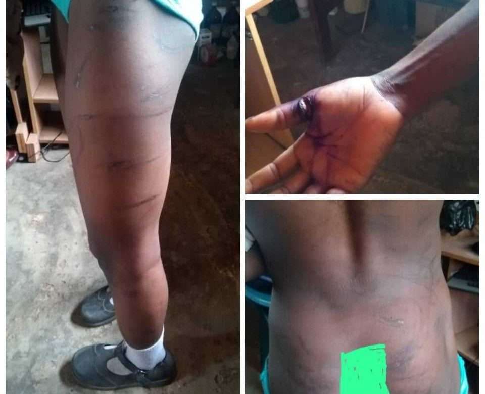 Mother And Daugther Arrested For Using Dangerous Objects, Inflicting Deep Cut Wound On Housemaid In PHC