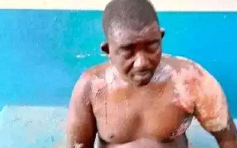 Wife Baths Husband With Hot Water 2 Months After Marriage Contract